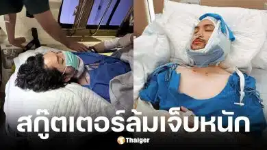ทอม อิศรา เปิดใจครั้งแรก หลังสกู๊ตเตอร์หลังล้มเจ็บหนัก