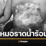 หมอราดน้ำร้อนใส่อกเด็ก 3 ขวบ แผลเหวอะ รักษาช้าถึงตาย อึ้งซ้ำ หลังขุดประวัติหมอ