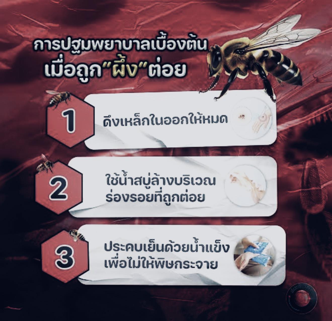 การปฐมพยาบาลเมื่อโดนผึ้งต่อย