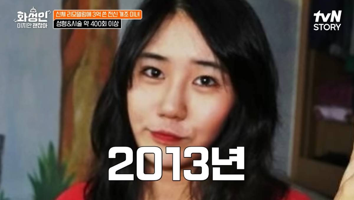 หน้าเก่า สาวเกาหลีศัลยกรรม 400 ครั้ง ตอนปี 2013