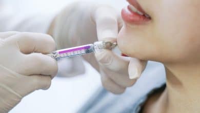 ฉีดฟิลเลอร์คาง