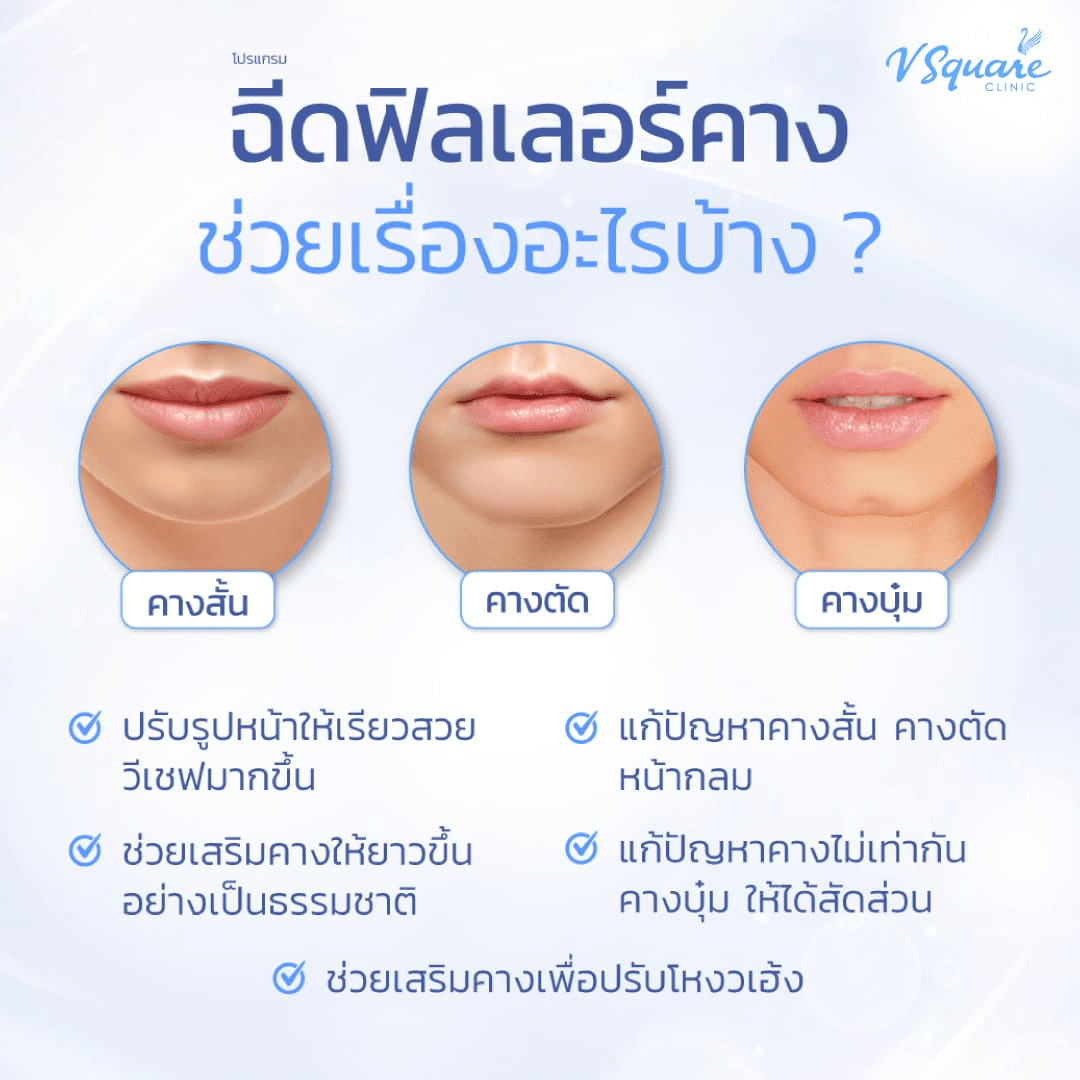 ฉีดฟิลเลอร์คาง ช่วยอะไร ?