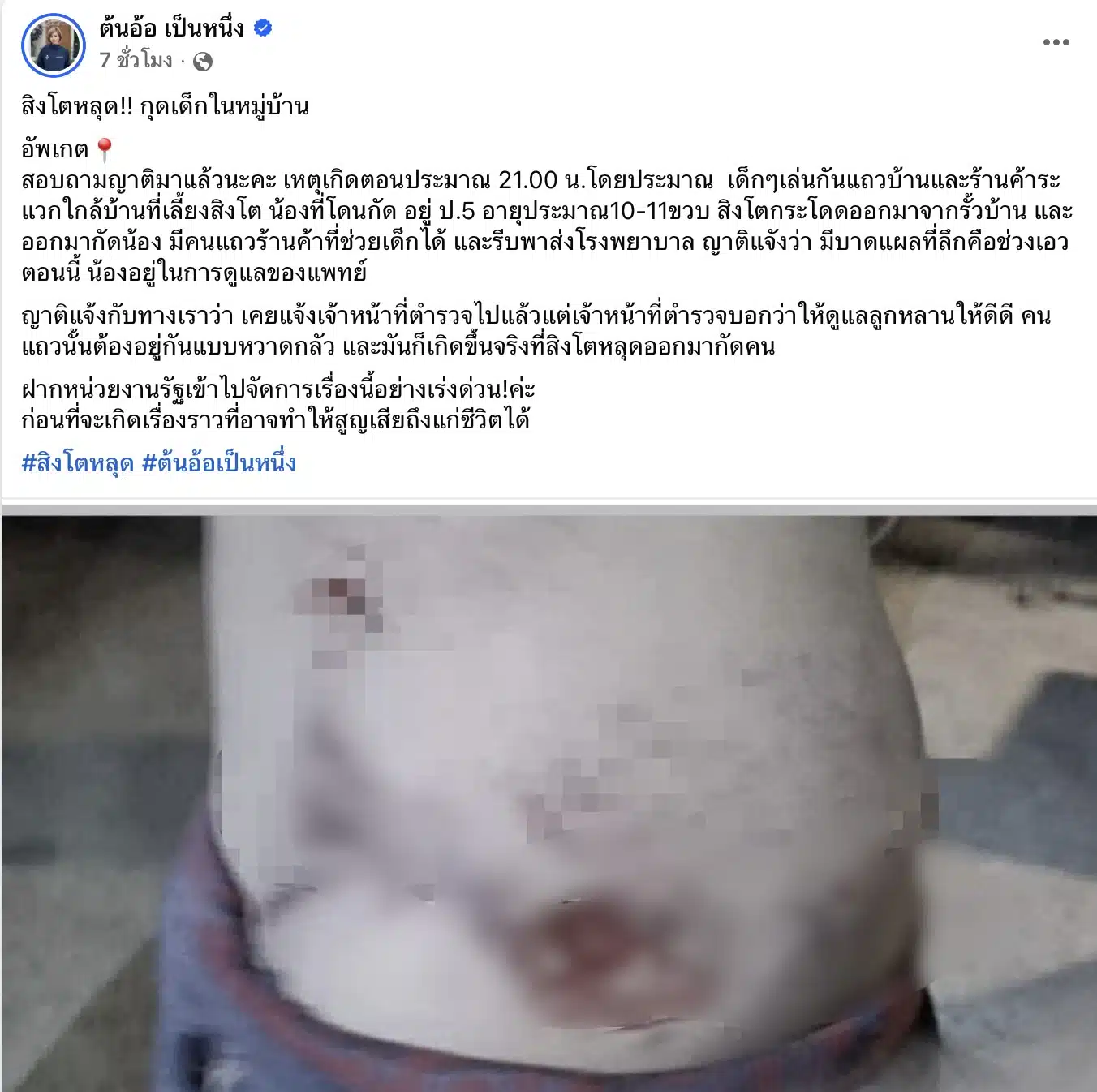 ต้นอ้อแจ้งข่าวสิงโตหลุดกัดเด็ก