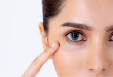 ฟิลเลอร์ใต้ตา