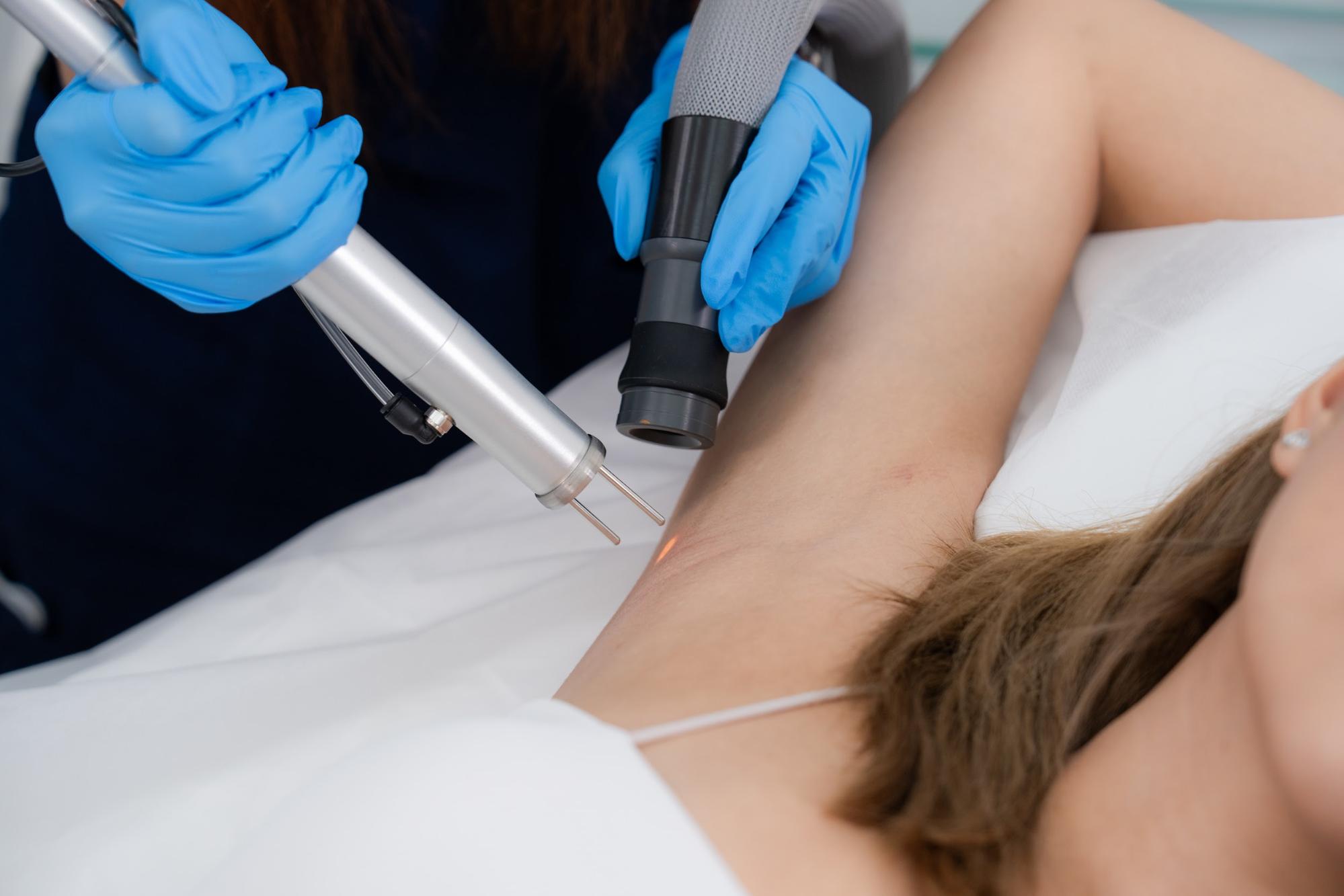 เลเซอร์รักแร้ขาว