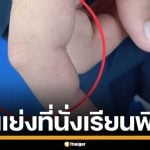 เด็กนักเรียน ป.5 ถูกแม่เพื่อนฉุนจัด ตบหน้า-หักนิ้ว คาที่เรียนพิเศษ เหตุแย่งที่นั่ง