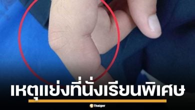 เด็กนักเรียน ป.5 ถูกแม่เพื่อนฉุนจัด ตบหน้า-หักนิ้ว คาที่เรียนพิเศษ เหตุแย่งที่นั่ง