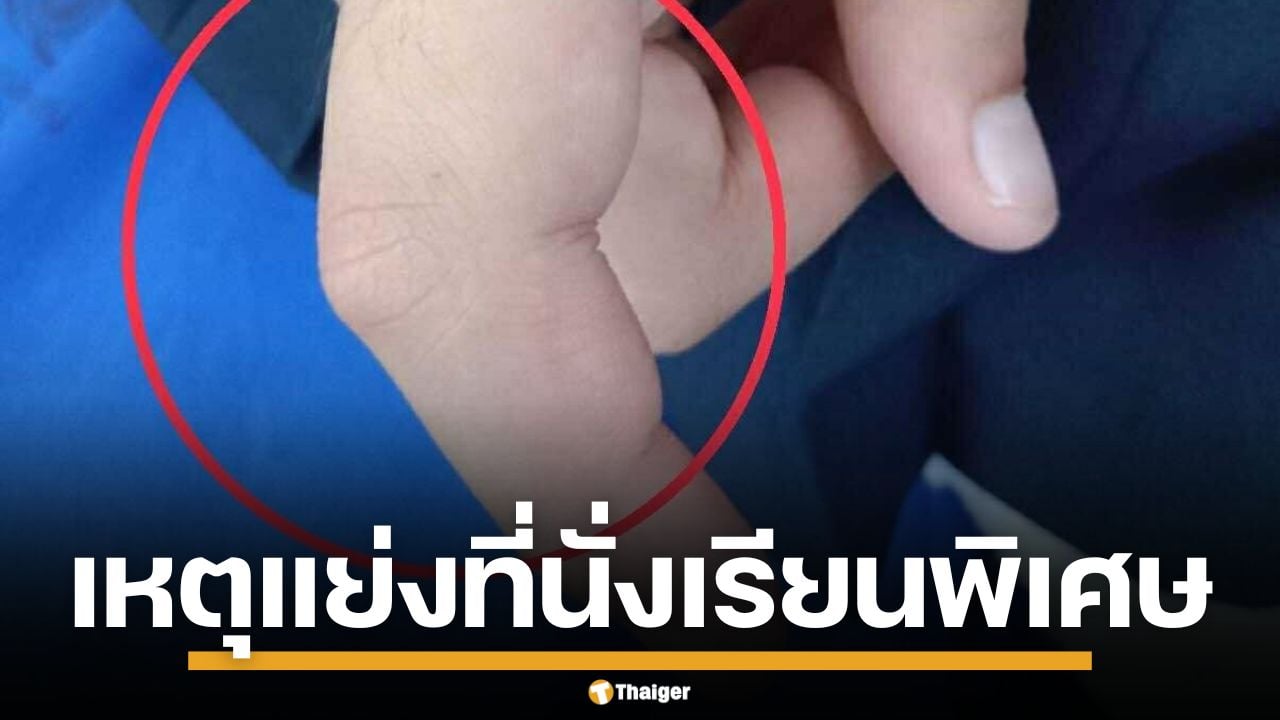 เด็กนักเรียน ป.5 ถูกแม่เพื่อนฉุนจัด ตบหน้า-หักนิ้ว คาที่เรียนพิเศษ เหตุแย่งที่นั่ง