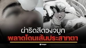 สาวโพสต์อุทาหรณ์ แฟนผ่าตัดวันแรกตาบวมเลือดคั่ง หมอเพิ่งแจ้งวันที่ 2 ว่าเสี่ยงบอด สุดท้าย รพ.ที่ 3 ยัน &quot;เส้นประสาทโดนตัด&quot;