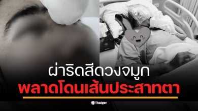 สาวโพสต์อุทาหรณ์ แฟนผ่าตัดวันแรกตาบวมเลือดคั่ง หมอเพิ่งแจ้งวันที่ 2 ว่าเสี่ยงบอด สุดท้าย รพ.ที่ 3 ยัน "เส้นประสาทโดนตัด"