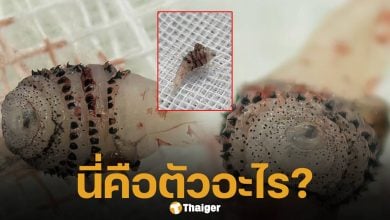 ขนลุก! หมอผ่าเจอ ตัวอ่อนแมลงวันบอทฟลาย ซุกใต้ผิวหนังคนไข้กลับจากบราซิล โซเชียลผวาหวั่นปรสิตระบาดในไทย