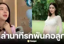 ไอซ์ อภิษฎา แชร์ประสบการณ์รกเสื่อมและพันคอเด็ก