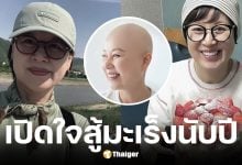 พัค มีซอน นักแสดงตลกเกาหลี สู้มะเร็งลามต่อมน้ำเหลือง