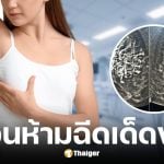 แพทยศาสตร์ศิริราช เตือนห้ามฉีดสารกระตุ้นคอลลาเจนที่เต้านม เสี่ยงเกิดก้อนแข็งอักเสบเรื้อรัง