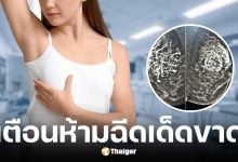 แพทยศาสตร์ศิริราช เตือนห้ามฉีดสารกระตุ้นคอลลาเจนที่เต้านม เสี่ยงเกิดก้อนแข็งอักเสบเรื้อรัง
