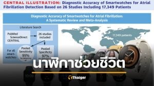 งานวิจัยเผย Smart Watch ตรวจจับโรคหัวใจได้จริง Samsung แม่นยำสุด