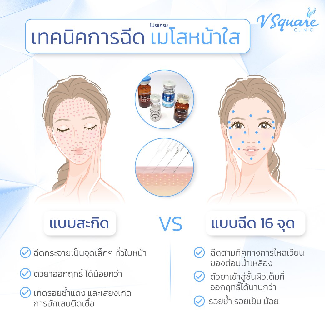 เทคนิคฉีดเมโสหน้าใส