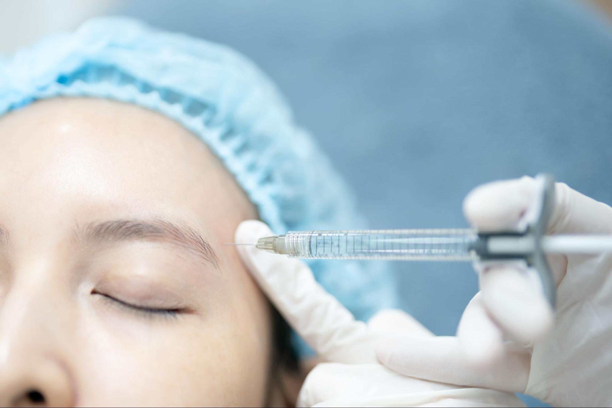 ฉีดฟิลเลอร์ขมับ