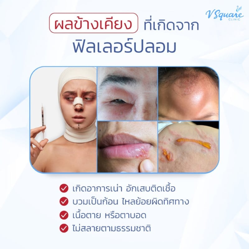 อันตรายจากการฉีดฟิลเลอร์ใต้ตา ราคาถูก