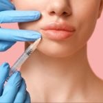 ฟิลเลอร์ปาก