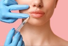 ฟิลเลอร์ปาก