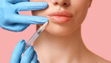 ฟิลเลอร์ปาก