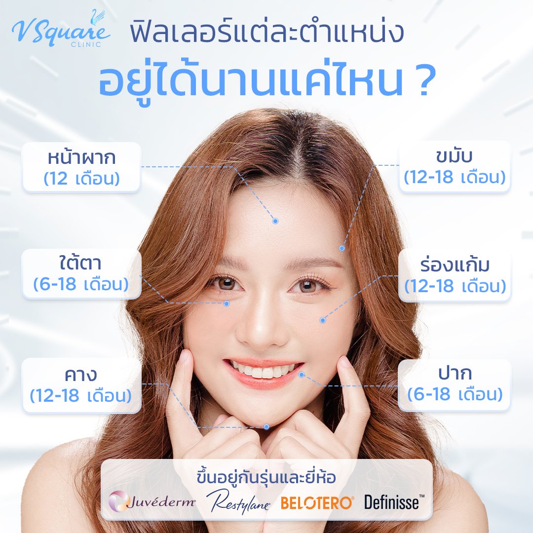 ฟิลเลอร์ อยู่ได้นานแค่ไหน