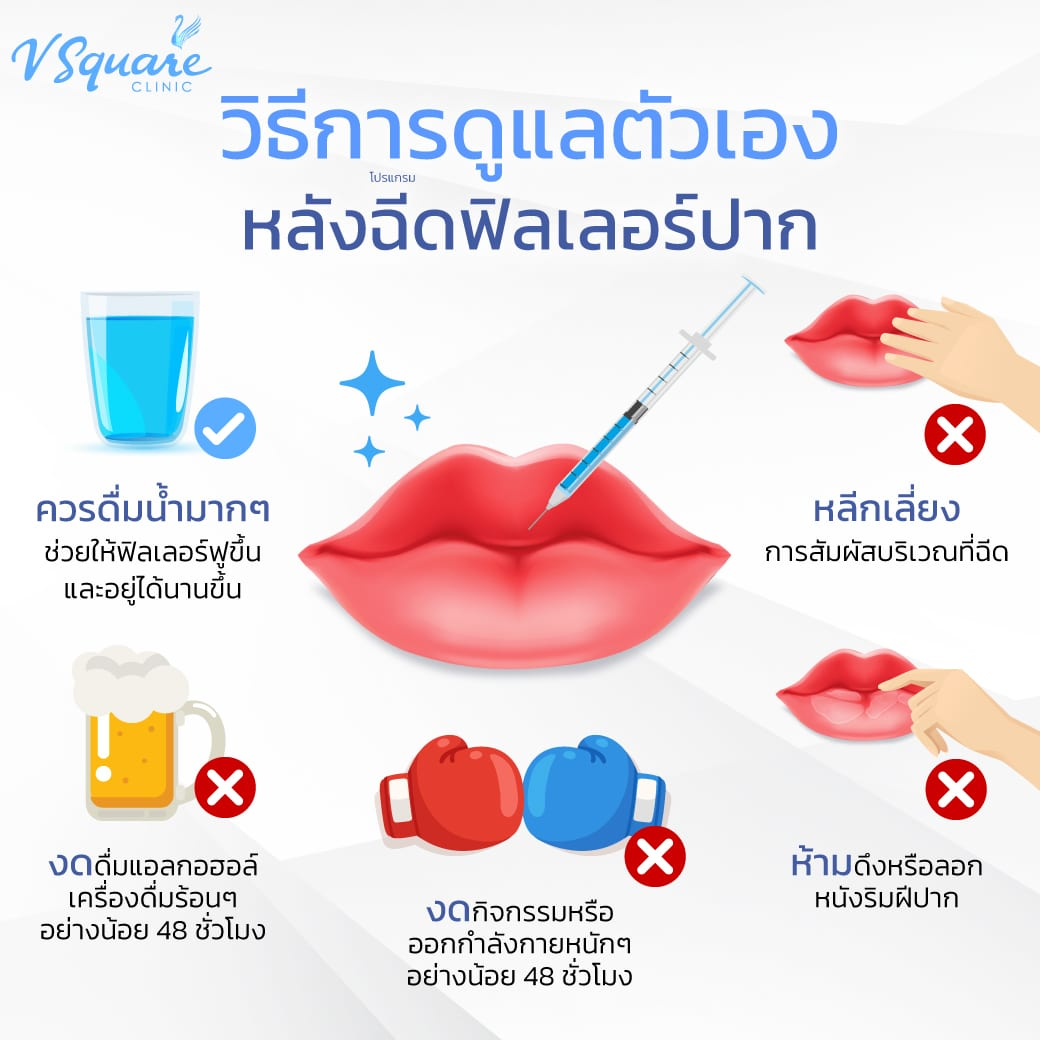 วิธีดูแลหลังฉีดฟิลเลอร์ปาก