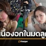 เก้า สุภัสสรา ตรวจเจอเนื้องอกในมดลูก