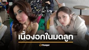 เก้า สุภัสสรา ตรวจเจอเนื้องอกในมดลูก