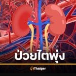 วิกฤต &#039;โรคไตเรื้อรัง&#039; พุ่ง 788 ล้านคน 7 สัญญาณ &#039;ฆาตกรเงียบ&#039; คนไทยเป็นเยอะมาก