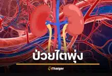 วิกฤต &#039;โรคไตเรื้อรัง&#039; พุ่ง 788 ล้านคน 7 สัญญาณ &#039;ฆาตกรเงียบ&#039; คนไทยเป็นเยอะมาก