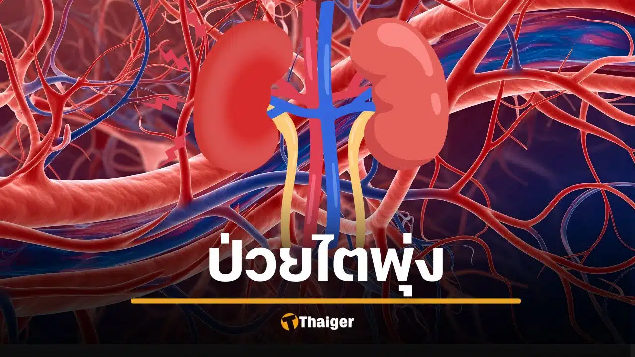 วิกฤต 'โรคไตเรื้อรัง' พุ่ง 788 ล้านคน 7 สัญญาณ 'ฆาตกรเงียบ' คนไทยเป็นเยอะมาก
