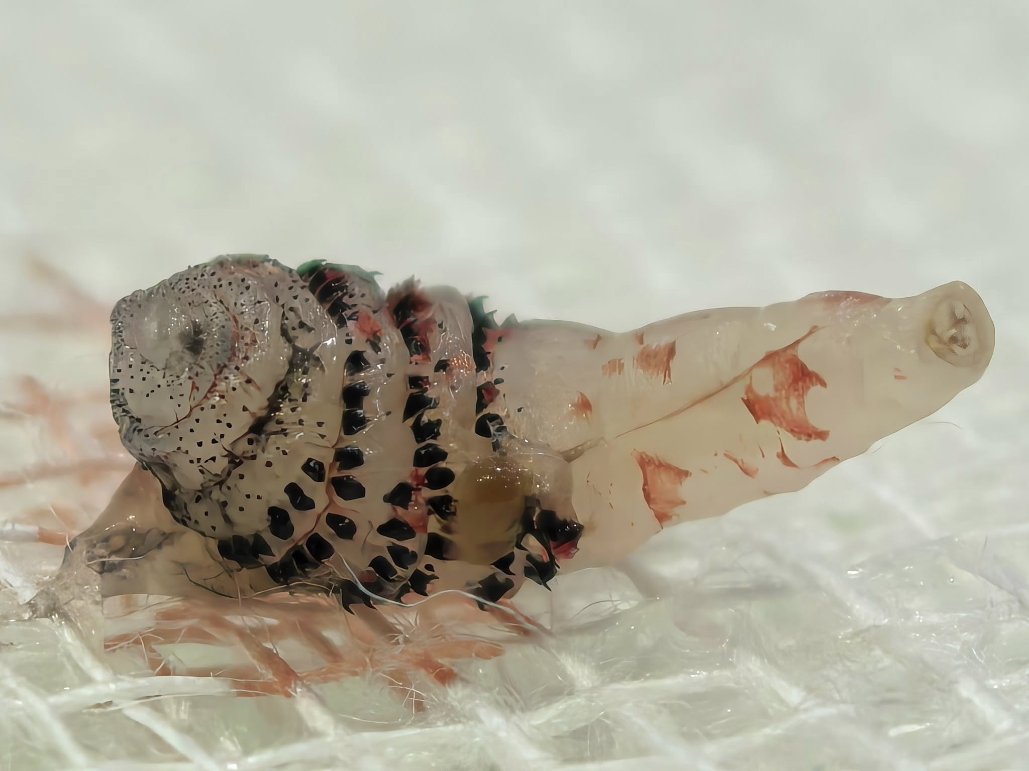 ขนลุก! หมอผ่า หนอนบอทฟลาย ซุกใต้ผิวหนังคนไข้กลับจากบราซิล โซเชียลผวาหวั่นระบาดในไทย-4