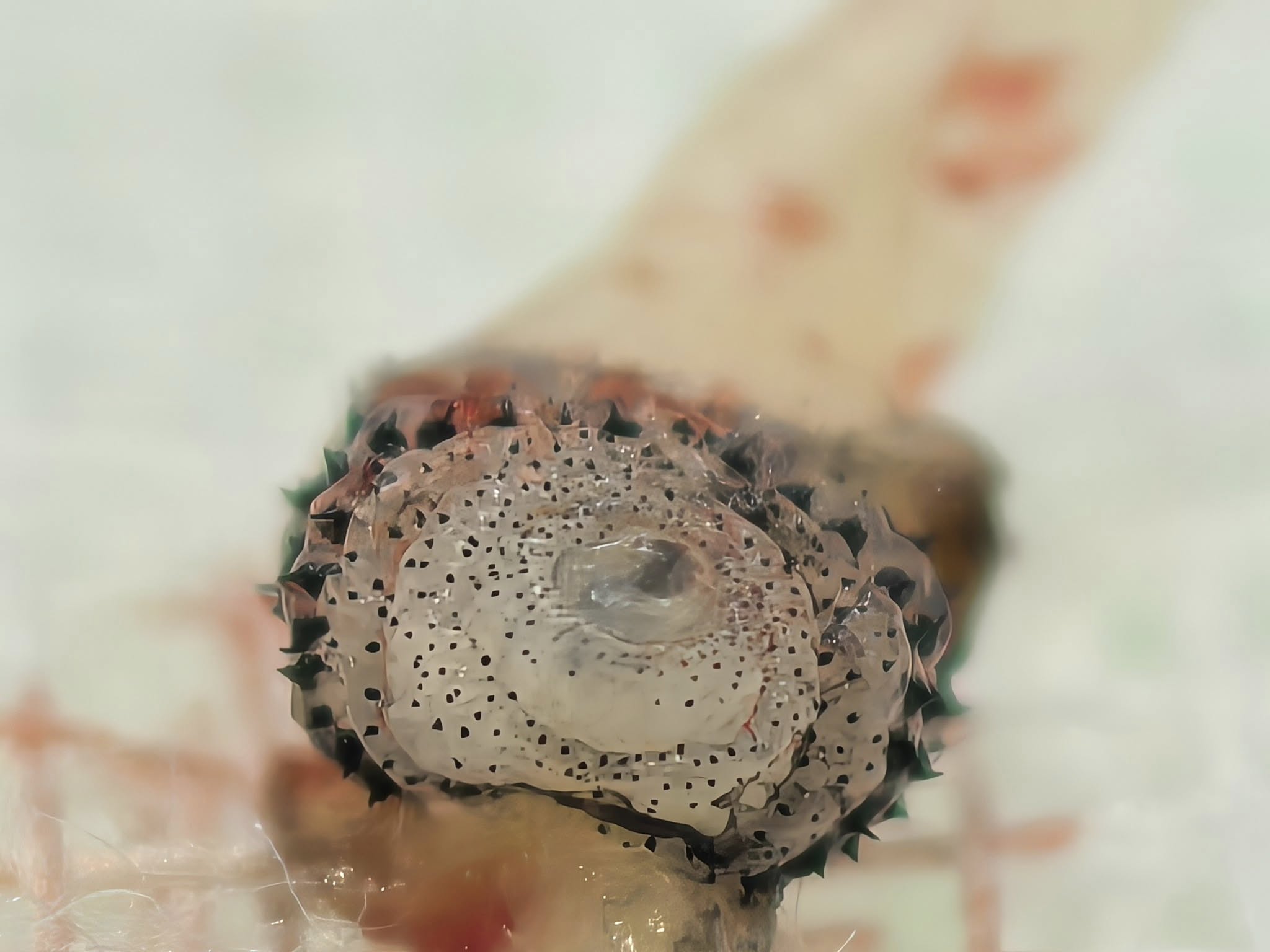 ขนลุก! หมอผ่า หนอนบอทฟลาย ซุกใต้ผิวหนังคนไข้กลับจากบราซิล โซเชียลผวาหวั่นระบาดในไทย-5