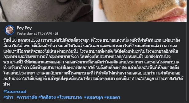 สาวโวย ผ่าตัดไม่ดี