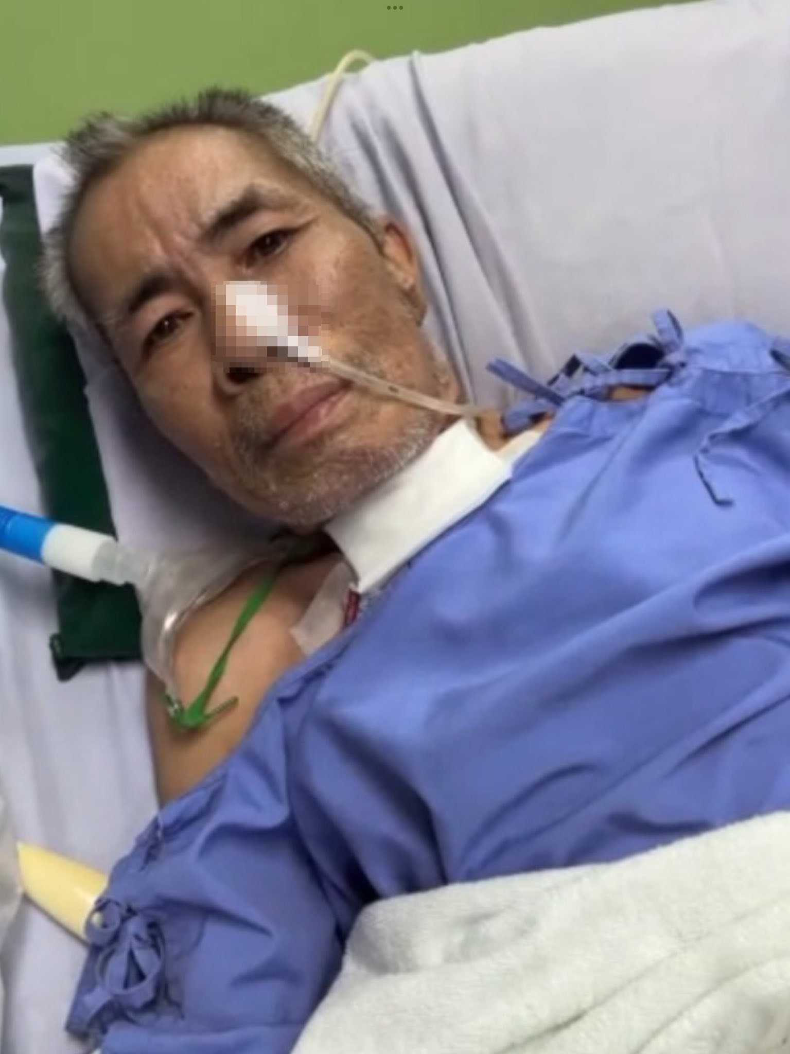 อาการล่าสุด ตลกรุ่นใหญ่ป่วยหนัก ถูกเจาะคอ-ไม่มีเสียงพูด แฟนๆ ส่งกำลังใจ-3