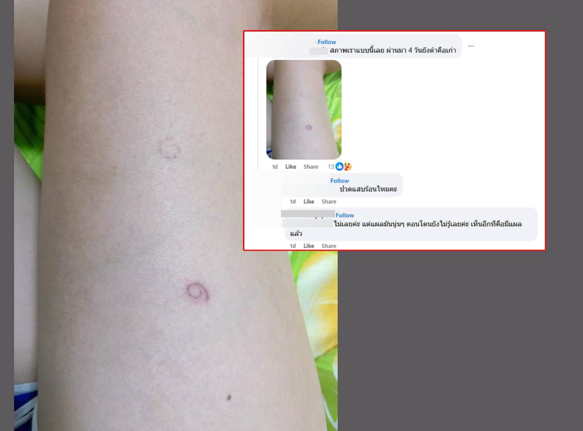 เคยทับตัวกิ้งกือ