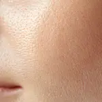 รูขุมขว้างกว้างเกิดจากอะไร