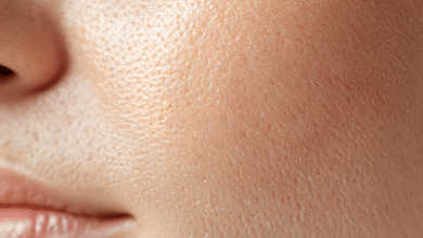 รูขุมขว้างกว้างเกิดจากอะไร