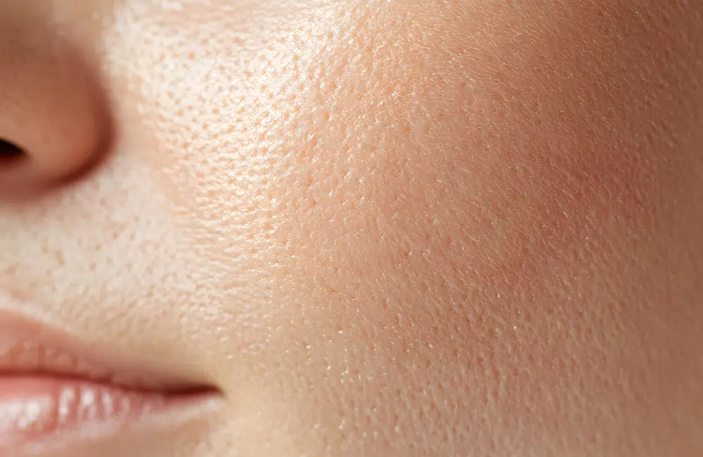 รูขุมขว้างกว้างเกิดจากอะไร