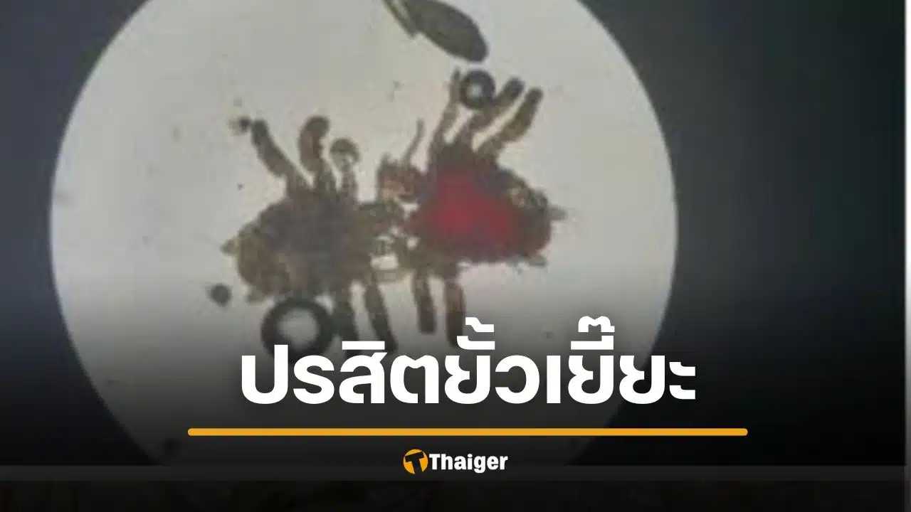 สยอง หนุ่มคันโคน "น้องชาย" นานแรมปี กินยาไม่หาย หมอถึงผงะ เจอเดินยั้วเยี้ย