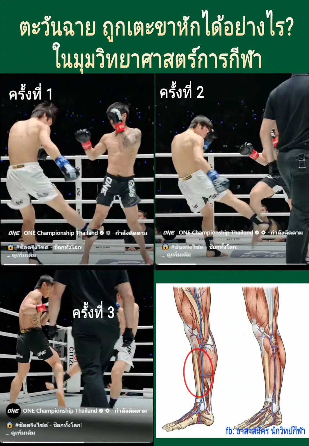 Monboonliang Pongnarin