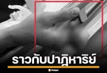 หนุ่มเวียดนาม ถูกเครื่องจักรบดนิ้วเละ 4 นิ้ว ทีมแพทย์ผ่าตัด 12 ชม. กู้มือคืนสำเร็จ