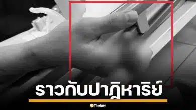 หนุ่มเวียดนาม ถูกเครื่องจักรบดนิ้วเละ 4 นิ้ว ทีมแพทย์ผ่าตัด 12 ชม. กู้มือคืนสำเร็จ