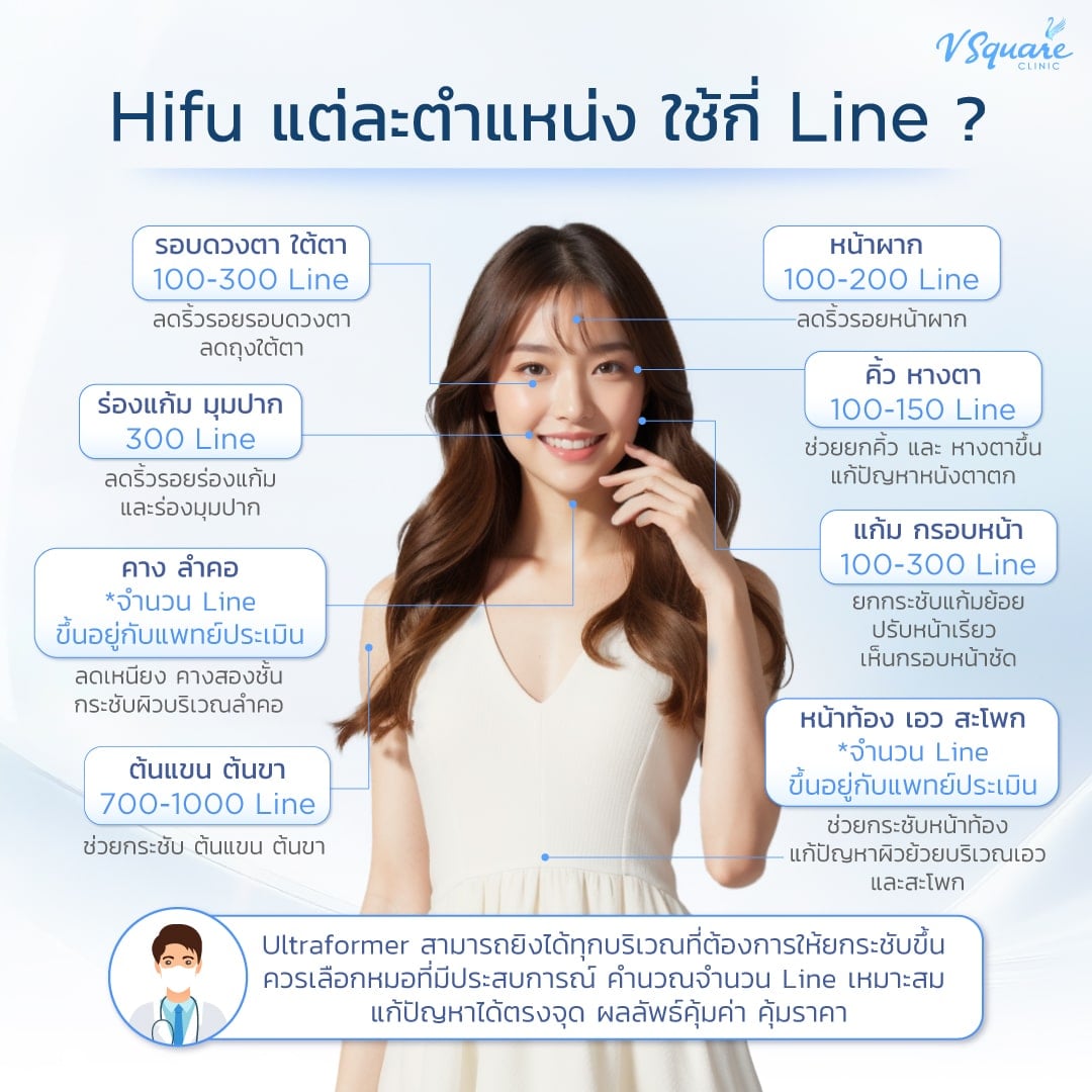 Hifu แต่ละจุดใช้กี่ไลน์