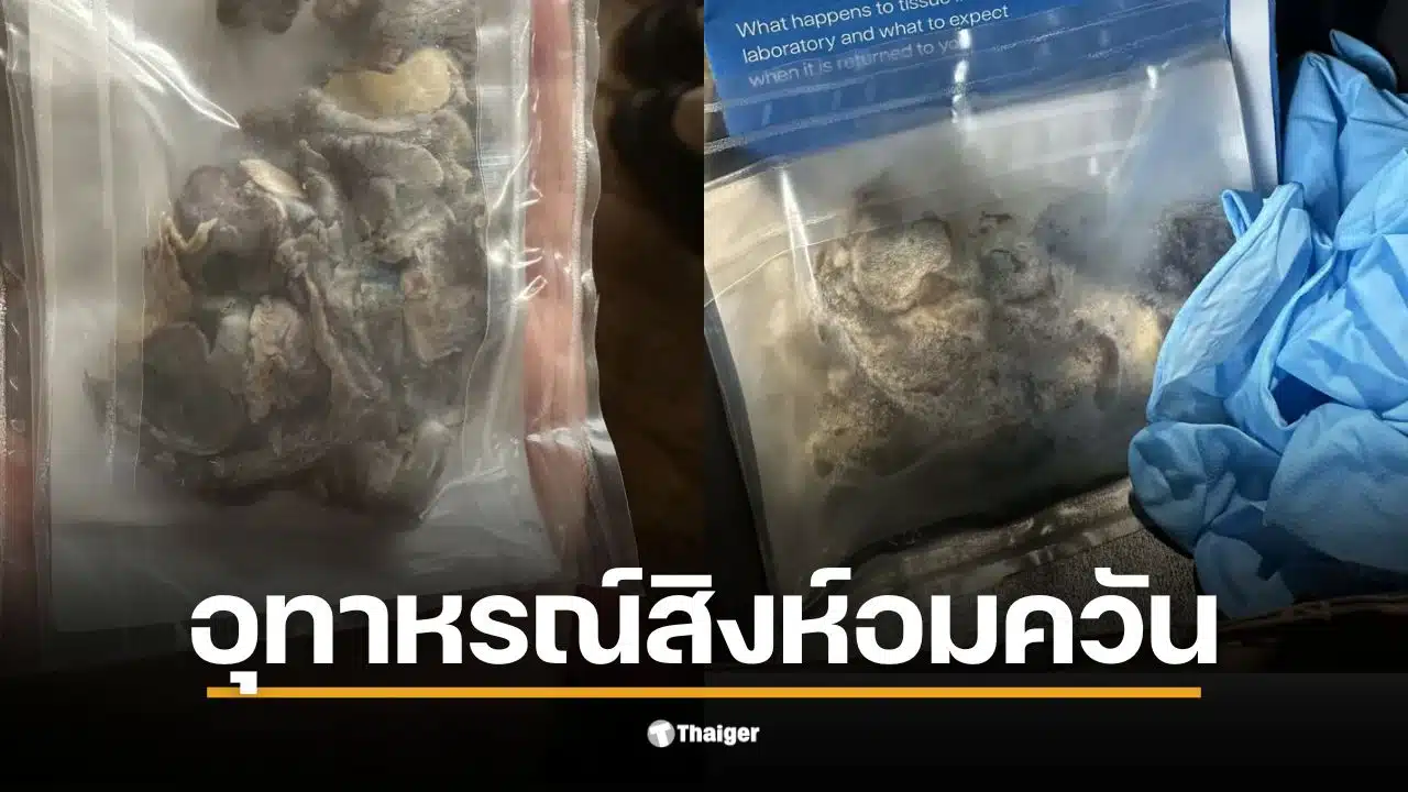 ภาพชิ้นส่วนปอดสีดำที่ถูกผ่าตัดออกจากร่างกายวัยรุ่นที่ติดบุหรี่ไฟฟ้า