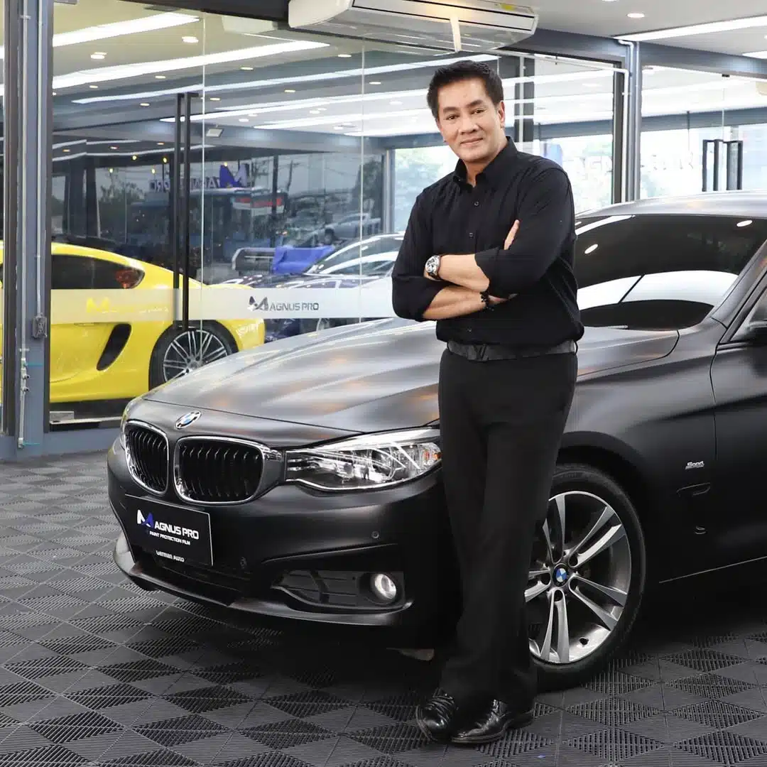 อาการล่าสุด ต้น จักรกฤษณ์ หลังผ่าเปิดหน้าท้อง ตัดถุงน้ำดีทิ้ง ซูบผอมจำแทบไม่ได้ -7