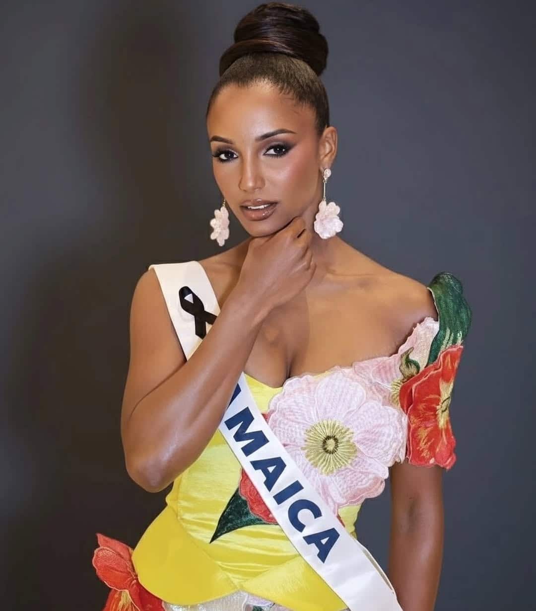 อาการล่าสุด มิสยูนิเวิร์สจาเมกาตกเวที สาหัส พบ เลือดออกในสมอง-สูญเสียการรับรู้-5