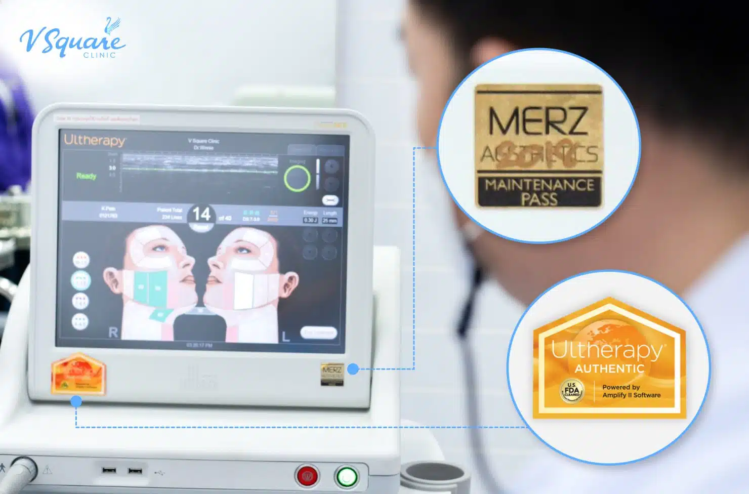 Ulthera คืออะไร